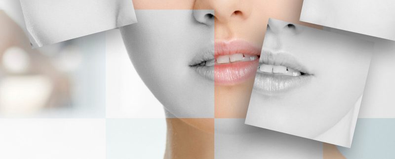Cirugía Maxilofacial